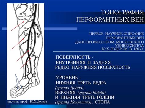 Расшифровка УЗАС вен нижних конечностей