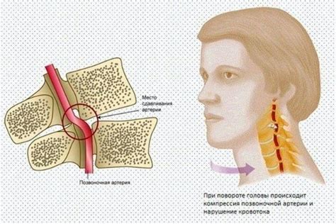 Существующие методы лечения синдрома Киммерли