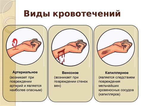 Анализ возможных толкований снов о кровотечении с пальца на конечности представительницы женского пола