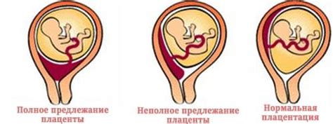 Анатомическая структура плаценты: что нужно знать