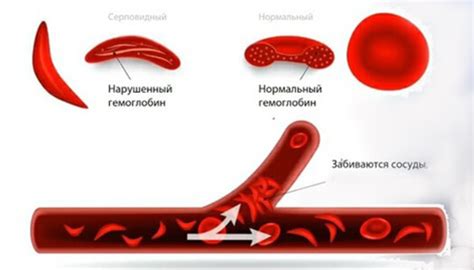 Анемия и проблемы с кроветворением