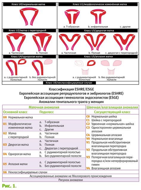 Аномалии развития