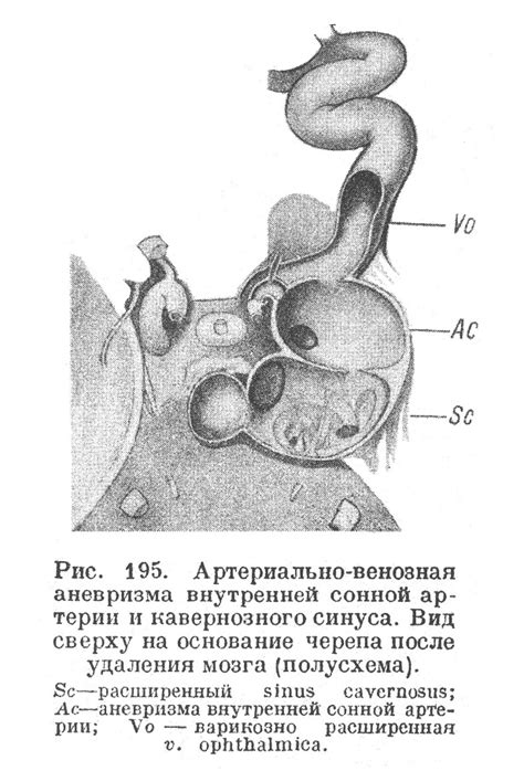 Артериально-венозная оксигенация