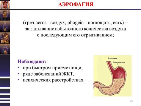 Аэрофагия и увеличение количества газов в желудке