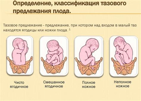 Важность определения правильного положения потомка перед родами