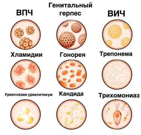 Венерические заболевания и их проявления в виде зуда и боли в половых губах у женщин