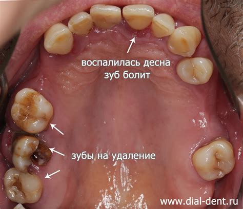 Вероятные значения сновидения, где выпал зуб переднего ряда без следов крови