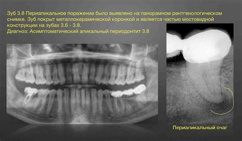 Виды деструкции в медицине