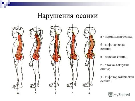 Виды и формы нарушения