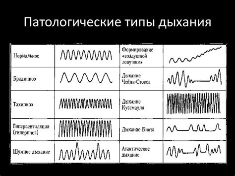 Виды нарушений дыхания и связь секретов носа