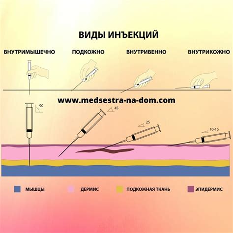 Виды уколов, способствующие уплотнению