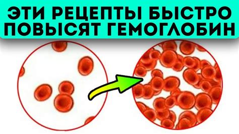 Влияние высокого гемоглобина на женское здоровье