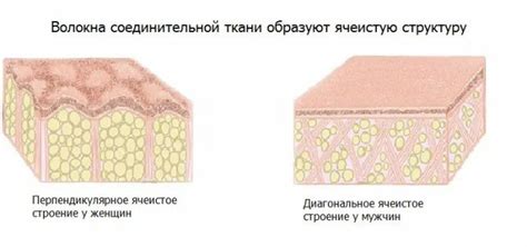 Влияние жирового и неправильного питания на появление апельсиновой кожи