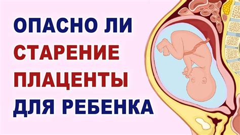 Влияние плаценты на роды