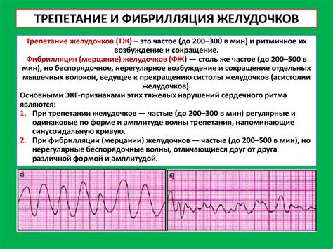 Влияние повышенной электрической активности левого желудочка на сердечную деятельность