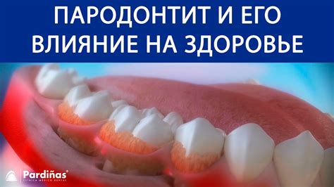 Влияние снов на состояние здоровья: необходимость обратить внимание на выпавший порченый зуб без неприятных ощущений