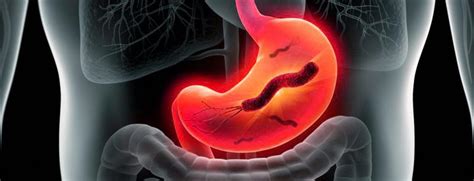 Влияние сомнительного результата на лечение Helicobacter pylori