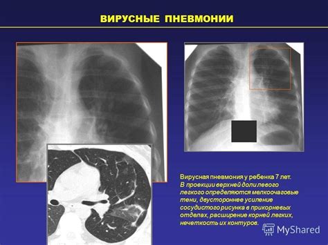 Влияние сосудистого рисунка на организм