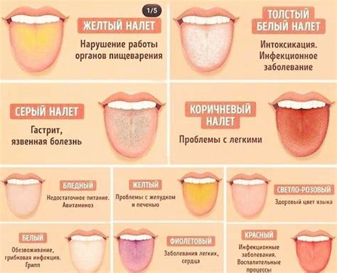 Влияние темного налета на языке на общее состояние здоровья