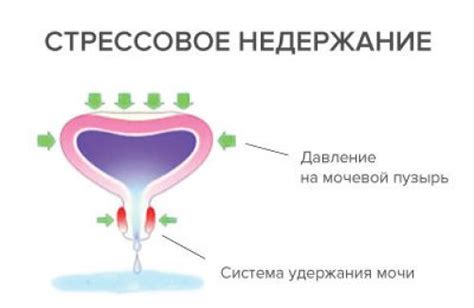 Влияние физической активности на давление на мочевой пузырь