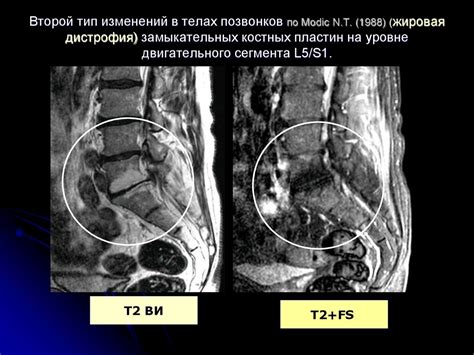 Влияние эмоций и сновидений о болезненных ощущениях в нижней части спины