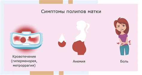 Возможные варианты лечения полипа без кровотока