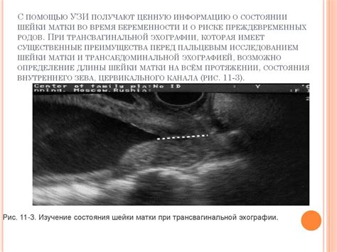 Возможные источники видений о УЗИ и состоянии беременности