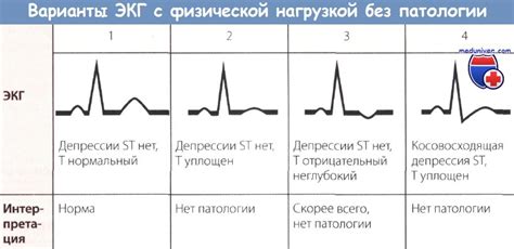 Возможные осложнения при отрицательной пробе с физической нагрузкой