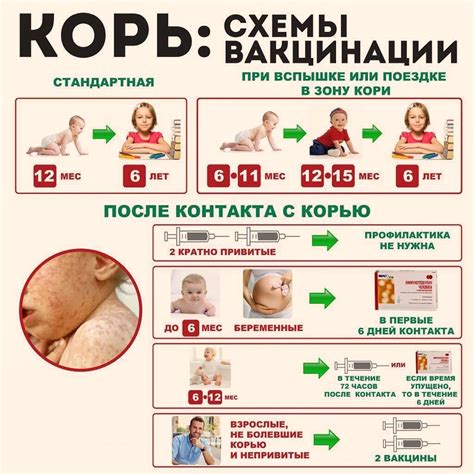 Возраст, в который детям ставят прививку от кори