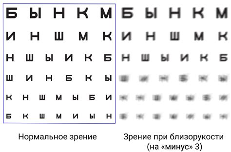 Возраст как фактор в проблемах с зрением