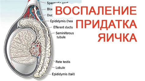 Воспаление придатков яичек