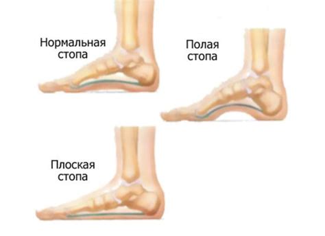 Вредные привычки и свод стопы