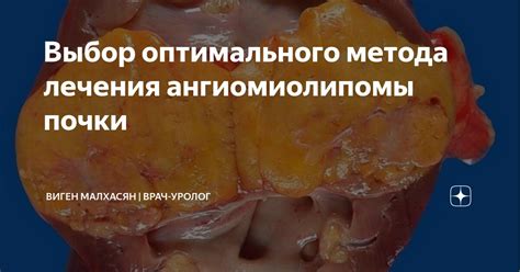 Выбор оптимального крепежного метода