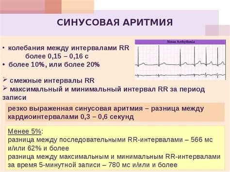 Выраженная синусовая аритмия: определение и причины