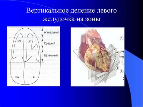 Выявление нарушения сократимости левого желудочка