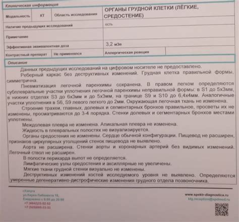 Вы украдены спортивные обувь - достаточно ли это для беспокойства?