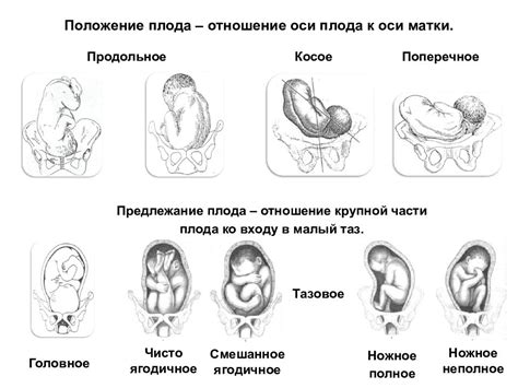 В чем заключается опасность неправильной позиции плода?