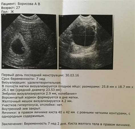 Где можно приобрести желточный мешок 2 8 мм и его стоимость