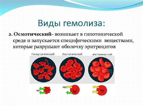 Гемолиз при заборе крови: причины и последствия