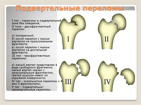 Детские кости: устойчивость к переломам и деформация