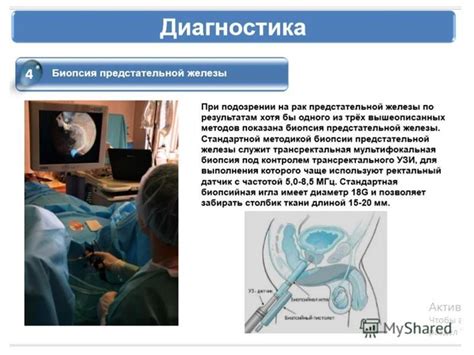 Диагностика С61 ЗНО предстательной железы