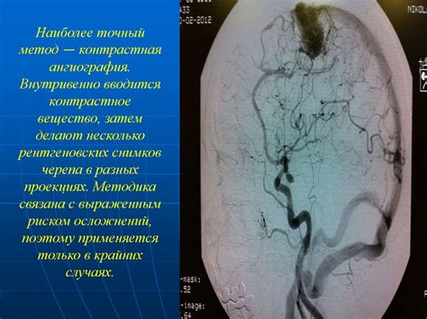 Диагностика венозной мальформации головного мозга