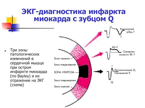 Диагностика гипоксических изменений миокарда