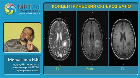 Диагностика единичных очаговых изменений