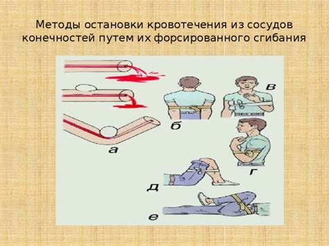 Диагностика и методы лечения гингивального кровотечения без неприятных ощущений