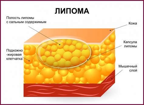 Диагностика и обследование жировика