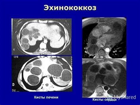 Диагностика и обследование печени