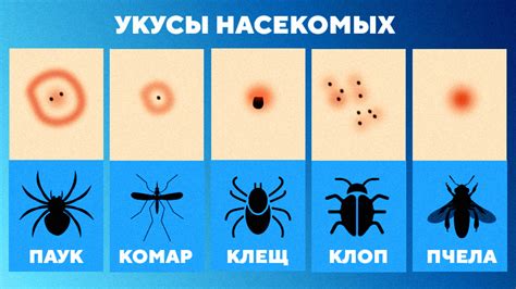 Диагностика отравления от насекомых