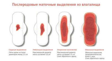 Длительность кровотечения после кесарева секции