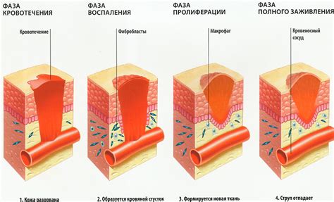 Естественное заживление ран